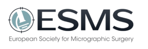 Esms Lentigo maligna and melanoma in situ - ESMS MOHS